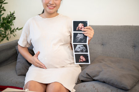 Close up of pregnant asian woman holding ultrasound pictures and touching belly while sitting on sofa in house. Prenatal care, Mother and unborn baby.の写真素材