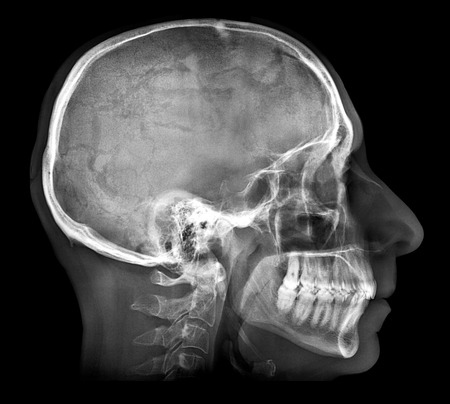 Human skull X-ray image isolated on blackの写真素材