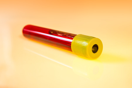 Blood test tube isolated on orange backgroundの写真素材