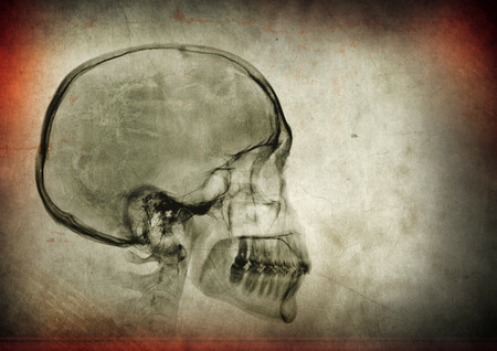 X-ray skull image on a dark textured background