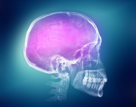 Human skull X-ray image on a colorful backgroundの写真素材