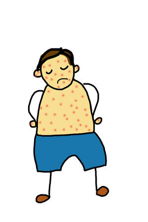 little boy is sick with chickenpox の写真素材