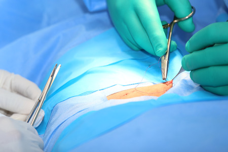 Macro shot of doctors making a suture in operation room.  Focus in the tools.の写真素材