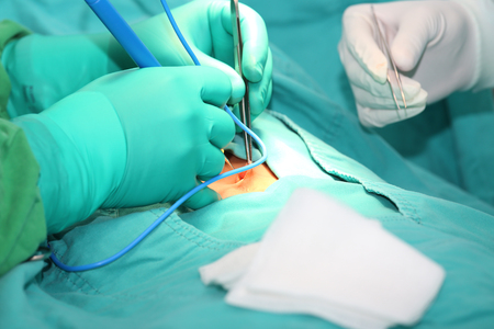 Doctor using an electronic scalpel in a surgeryの写真素材