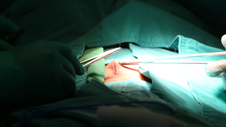 Close up of a suture in a surgeryの写真素材