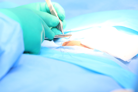 Doctor suturing an hernia.  Focus in the toolsの写真素材