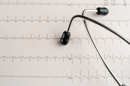 medical examination, electrocardiogram, heart medicine and therapyの写真素材
