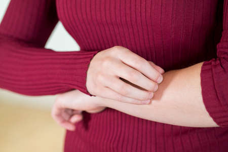 Close Up Of Woman With Skin Complaint Scratching Armの写真素材