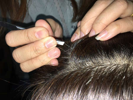 Close up iron clamp pull gray hair on head old female.の写真素材
