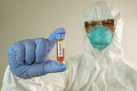 Blood sample in swap tube Coronavirus 2019 COVID-19 Test. on hand of scientist with biohazard protective clothing uniform During coronavirus covid-19 outbreak, Concept of pandemic virus.の写真素材
