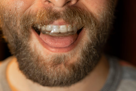 Beard man with a discharge splint