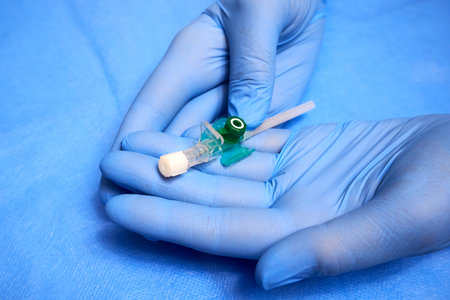 Ryazan, Russia - October 23, 2022: Intravenous catheter in the hands of a medic close-upのeditorial素材