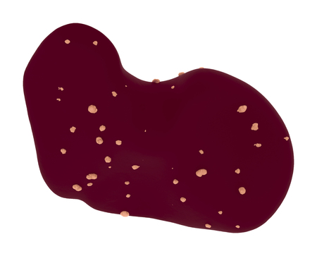 Liver With Hepatocellular Carcinoma, Malignant (Cancerous) Nodules On A Liver. Medical Science And Research Conceptの写真素材