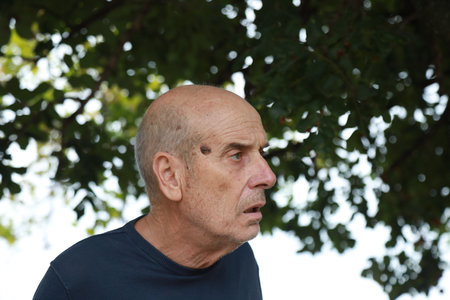 Shocked Elderly Man Loses Orientation And Forgets Everything In Natureの写真素材