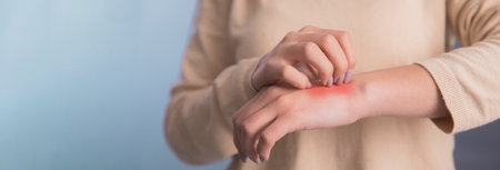 Woman scratch the itch with handの写真素材