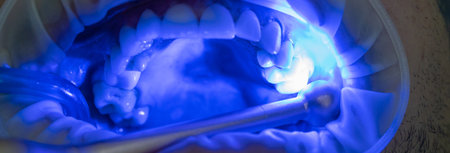 The dentist treats the patient's teeth, photo of the open mouth of the patient who came to the dental clinic, medical conceptの写真素材