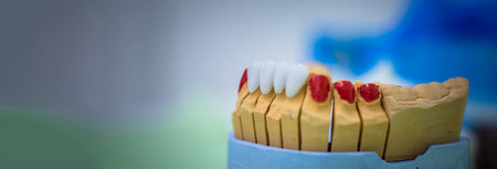 appliance for designing ceramic teeth, medical concept, dental clinic, stock photoの写真素材