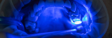 The dentist treats the patient's teeth, photo of the open mouth of the patient who came to the dental clinic, medical conceptの写真素材