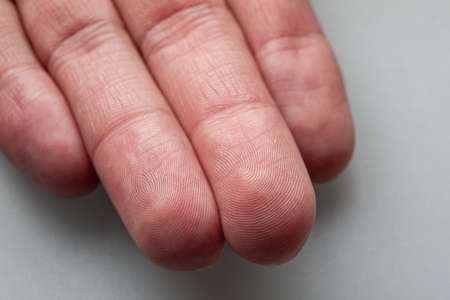 Papillary lines relief lines on the palm and plantar surfaces, close-up, fingerprinting, fingerprint, unique patternの写真素材