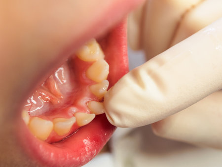 Milk bite and tooth change in children, the process of tooth growth and change in early childhood, close-up.の写真素材