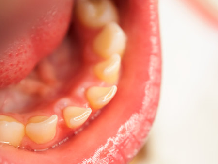 Milk bite and tooth change in children, the process of tooth growth and change in early childhood, close-up.の写真素材