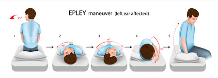 Epley maneuver left ear affected vector illustrationのイラスト素材