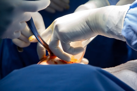 Open breast surgery, placing a prosthesis. Close-up of the breast and the hands and tools of the...