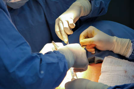 Close-up of the hands of surgeons operating a patient in a sterile operating room.の写真素材