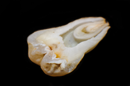close-up cut toothの写真素材