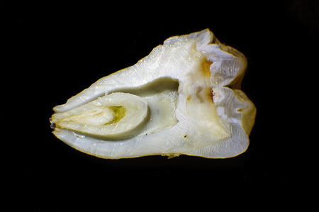 close-up cut toothの写真素材