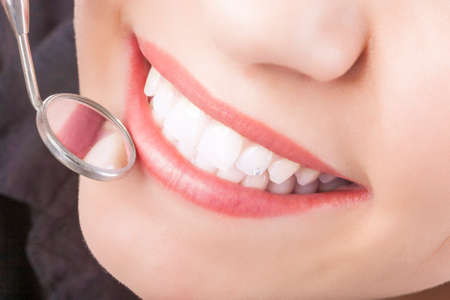 Dental Treatment with Mouth Mirror of Young Caucasian Female During Her Oral Examination. Horizontal Imageの写真素材