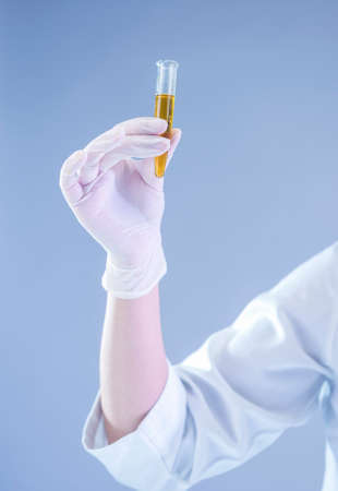 Medical Ideas and Concepts. Closeup of Hands Of Female Laboratory Worker with Flask Filled with...