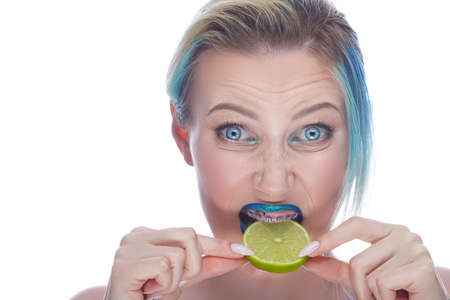 Caucasian Female with Teeth Braces and Smooth Skin Posing With Green Apple As Dental Care Ideas Against White. Horizontal imageの写真素材