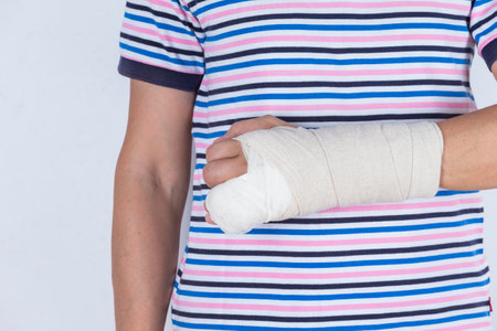Closeup of Body Parts of Caucasian Man in Striped Shirt with Broken Hand In Plaster and Bandaid Isolated on White Background. Horizontal Shotの写真素材