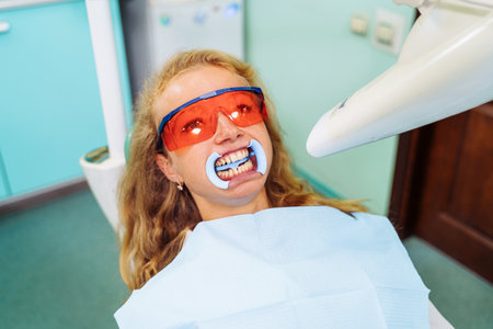 Teeth whitening. A patient in protective glasses from the rays in the chair at the dentist. Preventive examination of the oral cavity. Installing the mouth spacer. At the dentist appointment.の写真素材