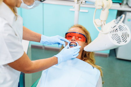 Teeth whitening. A patient in protective glasses from the rays in the chair at the dentist. Preventive examination of the oral cavity. Installing the mouth spacer. At the dentist appointment.の写真素材
