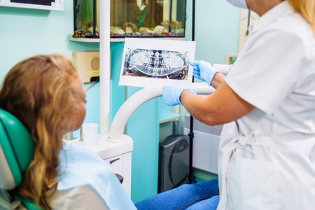 Highly qualified dentist offers the patient effective solutions to dental problems. Examination of the oral cavity according to the jaw image. The doctor shows the patient an x-ray.の写真素材