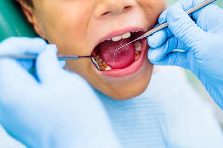 Effective solution to dental problems of teenager. Pediatric dentistry requires special attention and high competence. Tooth with caries. Bor machine effectively removes black spots on child's tooth.の写真素材