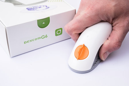Sydney, Australia - 2022-07-31 CGM - Continuous glucose monitoring: Dexcom g6 sensor for Type 1 diabetesのeditorial素材