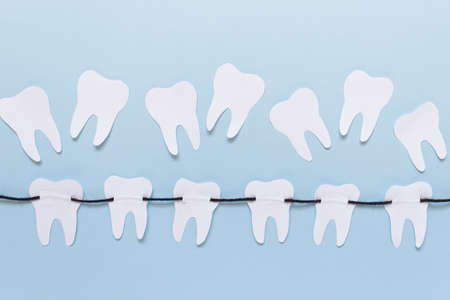 Simple dental medical concept with uneven teeth and tooth on black rope on blue background.