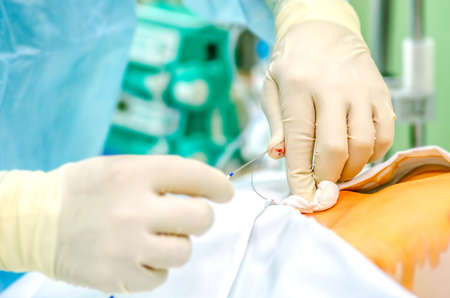 The process of setting the central catheter before the operation.の写真素材
