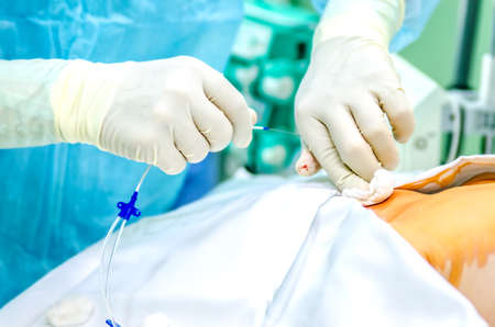 An anesthesiologist installs a central venous catheter to the patient before surgery.の写真素材