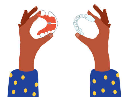 Female hands holding dental braces and orthodontic transparent retainers and choosing between them. Oral care,bite correction. Beautiful smile with straight teeth. Vector flat illustration for clinicのイラスト素材