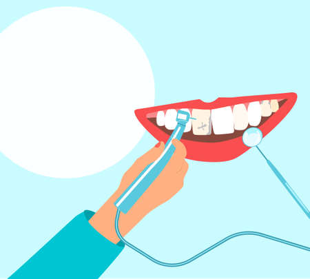 Dentist hand holding drill bit and cures teeth with caries, removing plaque.Human mouth with gums.Oral cavity disease.Root canal filling with orthodontic instruments.Template for dentistry officeのイラスト素材
