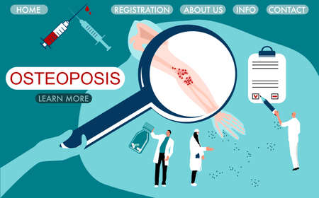 World Osteoporosis Day concept. Magnifier with brittle,porous and fragile bone.Tiny doctors make laboratory tests.Website template with arthrosis human hand.Elbow joint disease.Vitamin D deficiencyのイラスト素材