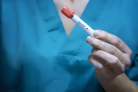 Doctor with a infected laboratory sample tube. Analysis and sampling of infectious diseases