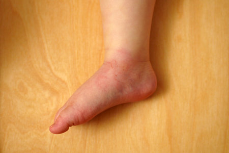 Red, swollen skin on a child's foot caused by a mosquito bite after outdoor play in the summerの写真素材