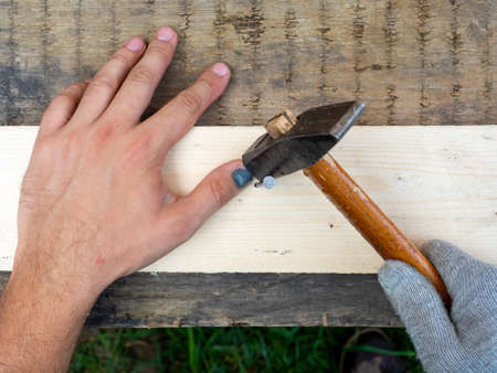 A close-up of a worker misses and hits the thumb of his hand. Hematoma, bruise, bruise. Grass at...
