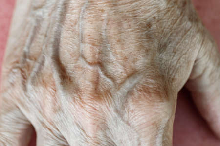 Elderly womans hand close-up, veins and skin pigmentation. Macroの写真素材
