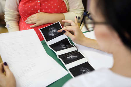 Young pregnant woman check up at doctors officeの写真素材